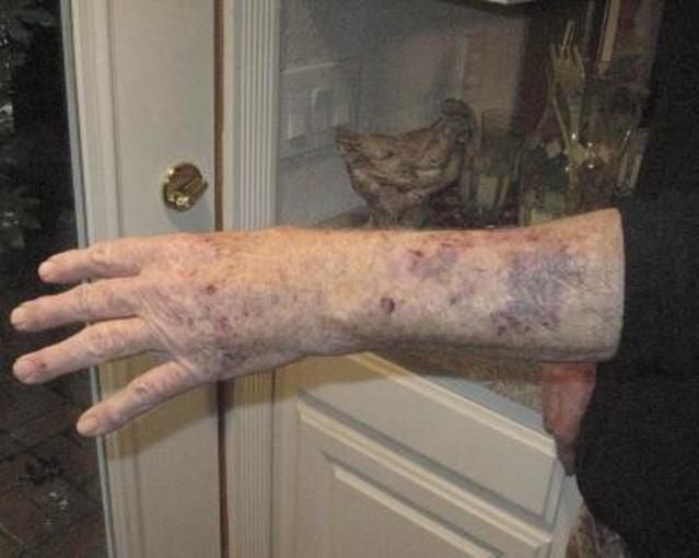 California hiker says bear saved him from mountain lion