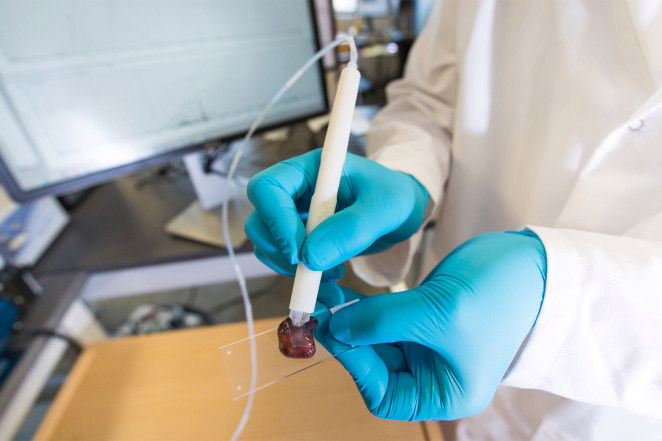 Scientists tout ‘pen’ that detects cancer in 20 seconds