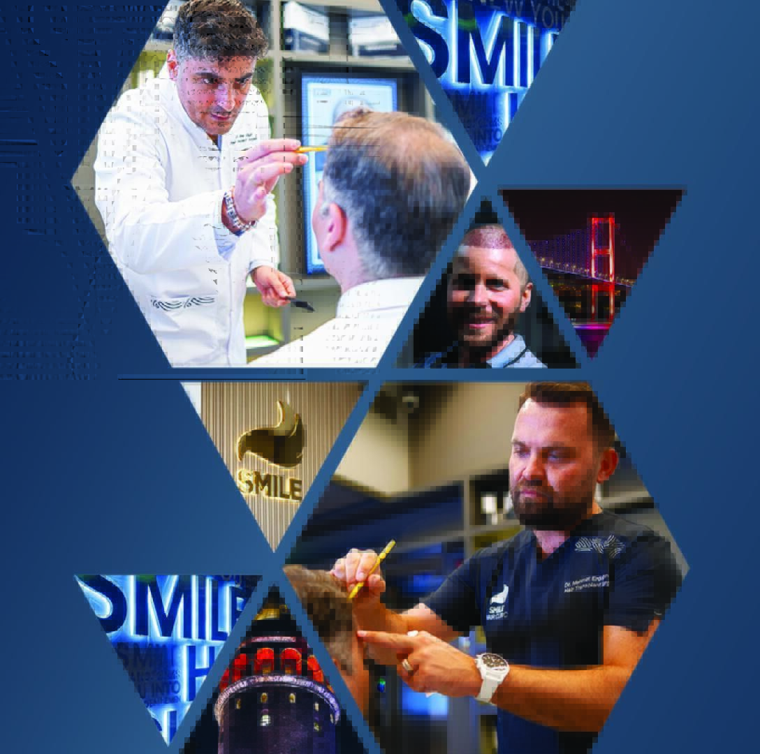 Top 10 Hair Transplant Doctors in the World 2025